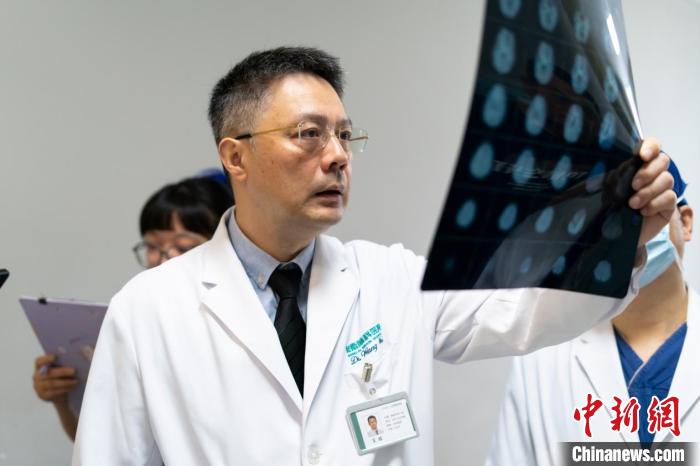 Two Strokes in Five Months: CEA Plus Bypass Surgery Restores Blood Flow for a Moyamoya Patient at Shanghai Donglei Brain Hospital